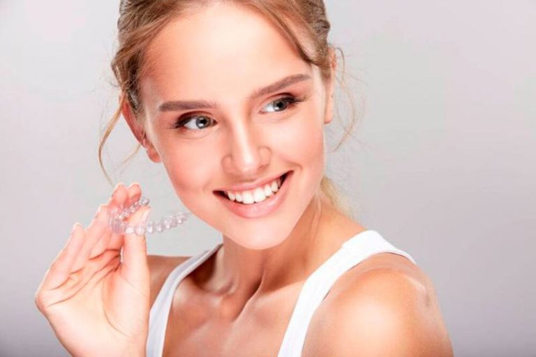 Invisalign Lite Sus Ventajas Y Cuando Est Recomendado Cl Nica Dental Per N