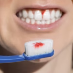 sangrado-de-encias-imagen-cepillo-con-sangre