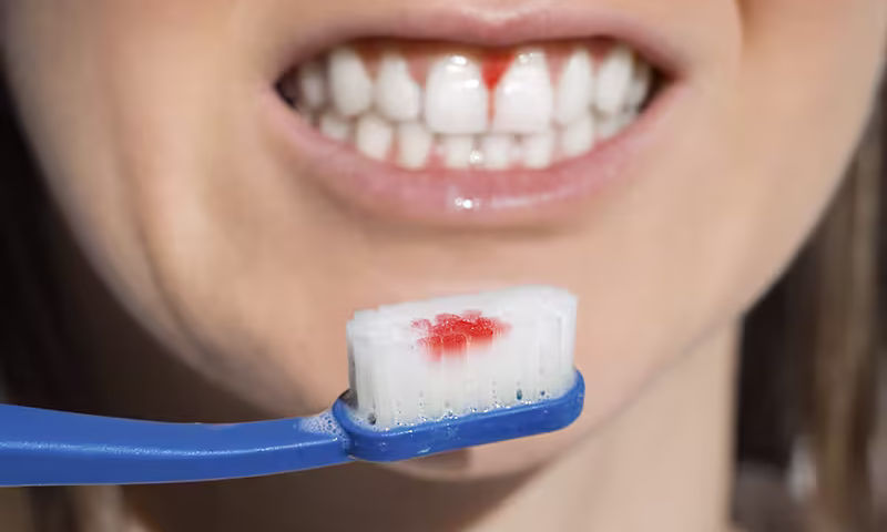 sangrado-de-encias-imagen-cepillo-con-sangre